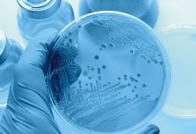 Legionellenwachstum. Foto: Fotolia